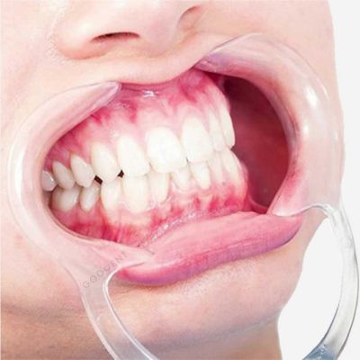 دهان بازکن دوطرفه نعلی