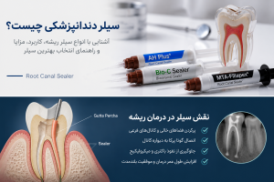 سیلر دندانپزشکی